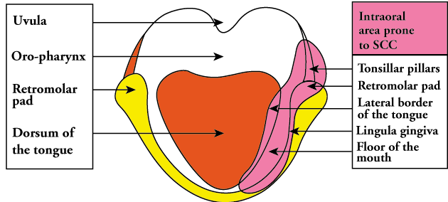 mirbodillus .gif (19831 bytes)