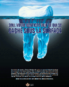 Affiche de la dent en forme d'iceberg