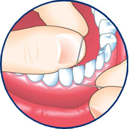 Slide the floss between your teeth and wrap it into a C shape around the base of the tooth and gently under the gumline. Wipe the tooth from base to tip two or three times