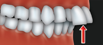 L'orthodontie à tout âge - Association dentaire canadienne