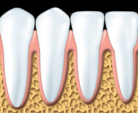 Periodontal 1