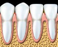 Periodontal 2