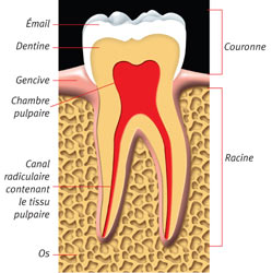 Image: Root Canal 1