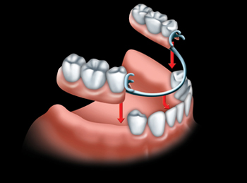 Denturist In Essex County