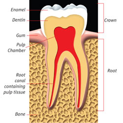 Image: Root Canal 1