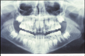 x-ray orthodontist 63141